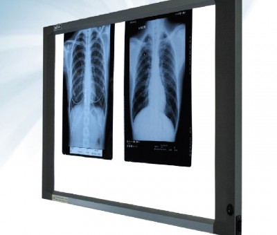 X ray films scrap